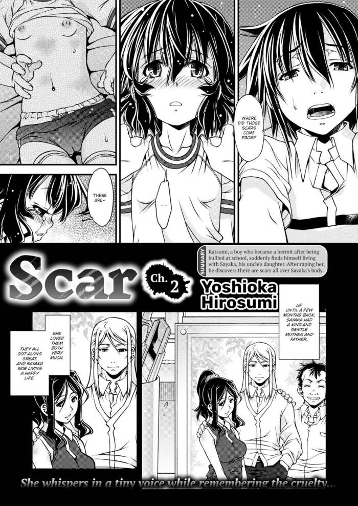 [Yoshioka Hirosumi] Scar Ch.2